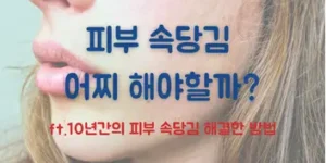 피부 속당김 해결방법