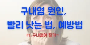 구내염 빨리 낫는법, 원인, 예방법